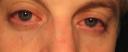 Red Pool Eyes